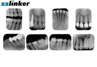 17 Lp / Mm دقة الأسنان داخل الفم الماسح الضوئي 14 بت مستوى رمادي حجم صغير