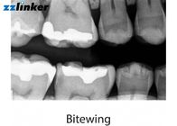 دقة عالية الأسنان X راي آلة الأسنان المحمولة X راي وحدة 1 سنة الضمان
